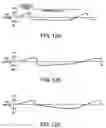 Fig. 12 - Positive pressure systems and methods for increasing blood pressure and circulation