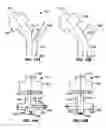 Fig. 13 - Positive pressure systems and methods for increasing blood pressure and circulation