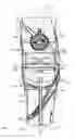 Fig. 04 - Cable Knee Brace System