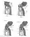 Fig. 09 - Internal and external disc shunts alleviate back pain