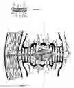 Fig. 23 - Internal and external disc shunts alleviate back pain