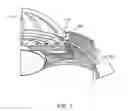 Fig. 02 - Glaucoma treatment device