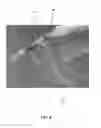 Fig. 06 - Visual indication of rupture of drug reservoir