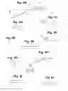 Fig. 08 - Devices And Methods For Minimally Invasive Access To Sinuses And Treatment of Sinusitis