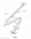 Fig. 02 - Over-the-wire balloon catheter for efficient targeted cell delivery