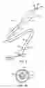 Fig. 03 - Over-the-wire balloon catheter for efficient targeted cell delivery