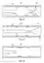 Fig. 06 - Over-the-wire balloon catheter for efficient targeted cell delivery