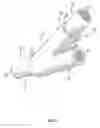 Fig. 02 - Pre-molded bifurcation insert
