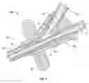 Fig. 04 - Pre-molded bifurcation insert