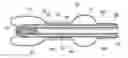 Fig. 01 - Balloon encapsulated catheter tip