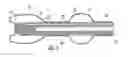 Fig. 08 - Balloon encapsulated catheter tip