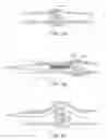 Fig. 04 - Methods for removing kidney stones from the ureter