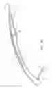 Fig. 06 - Methods for removing kidney stones from the ureter