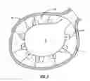 Fig. 03 - Vertebral body nerve and vein cauterizing system and method