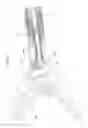Fig. 05 - HIGH-FREQUENCY TREATMENT INSTRUMENT