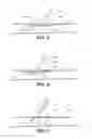 Fig. 04 - Devices and methods for temporarily retaining spinal rootlets within dural sac