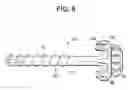 Fig. 07 - Preparatory reamers for orthopedic implants