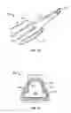 Fig. 09 - Devices and methods for storing, loading, and delivering an intraocular lens