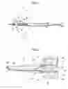 Fig. 02 - Intraocular lens insertion device