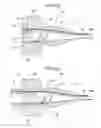 Fig. 06 - Intraocular lens insertion device