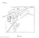 Fig. 09 - SHAPE MEMORY FILAMENT FOR SUTURE MANAGEMENT