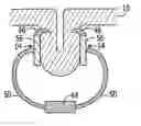 Fig. 01 - Soft tissue anchoring methods and devices