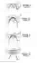 Fig. 02 - Soft tissue anchoring methods and devices