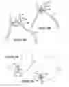 Fig. 19 - Soft tissue anchoring methods and devices