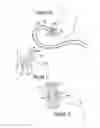 Fig. 20 - Soft tissue anchoring methods and devices