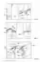 Fig. 07 - MAGNETICALLY ASSISTED CLASPS FOR PROSTHETIC IMPLANTS, AND RELATED METHODS