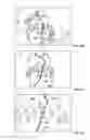 Fig. 09 - MAGNETICALLY ASSISTED CLASPS FOR PROSTHETIC IMPLANTS, AND RELATED METHODS