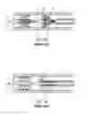 Fig. 02 - Interventional catheter for retrograde use having embolic protection capability and methods of use