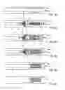 Fig. 04 - Interventional catheter for retrograde use having embolic protection capability and methods of use
