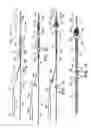 Fig. 02 - METHOD AND APPARATUS FOR CAPTURING OBJECTS BEYOND AN OPERATIVE SITE IN MEDICAL PROCEDURES