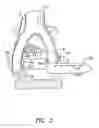 Fig. 04 - Methods and apparatus for vascular protection in spinal surgery