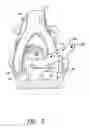 Fig. 06 - Methods and apparatus for vascular protection in spinal surgery