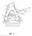 Fig. 07 - Methods and apparatus for vascular protection in spinal surgery