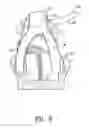 Fig. 09 - Methods and apparatus for vascular protection in spinal surgery