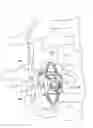 Fig. 01 - Interspinous process implant and method of implantation