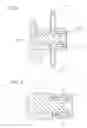 Fig. 08 - Interspinous process implant and method of implantation