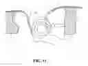 Fig. 09 - Methods and Apparatus For Treating Spinal Stenosis