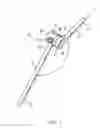 Fig. 02 - ADJUSTABLE VERTEBRAL ROD SYSTEM AND METHODS OF USE