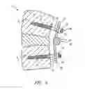 Fig. 06 - ADJUSTABLE VERTEBRAL ROD SYSTEM AND METHODS OF USE