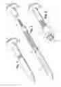 Fig. 02 - Method and apparatus for maxillo-mandibular fixation