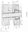 Fig. 07 - Variable angle screw plate systems