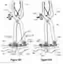 Fig. 06 - Methods for repairing bone discontinuities