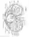 Fig. 04 - Method and system for preventing nerve injury during a medical procedure