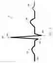 Fig. 04 - Frequency domain analysis to detect T wave oversensing