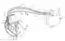 Fig. 01 - Minimum ventricular pacing to break the repetitive AR-VS pattern