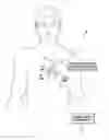Fig. 01 - Systems and methods for optimizing multi-site left ventricular pacing based on interelectrode conduction delays